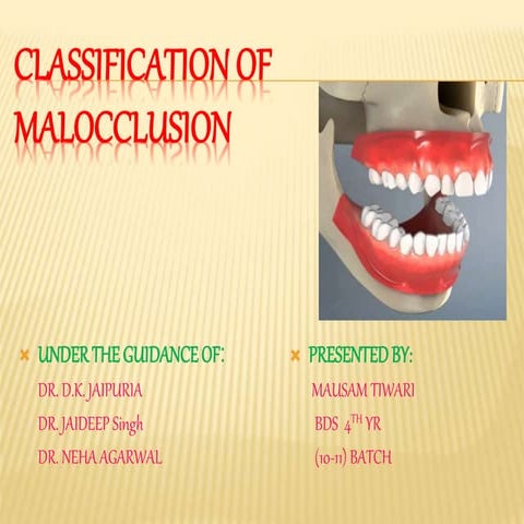 Classification of malocclusion