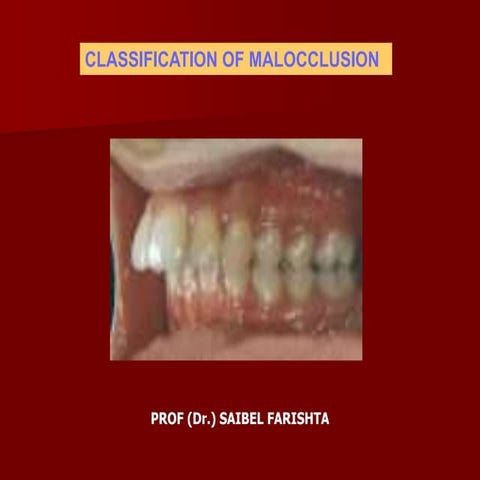 Classification of malocclusion