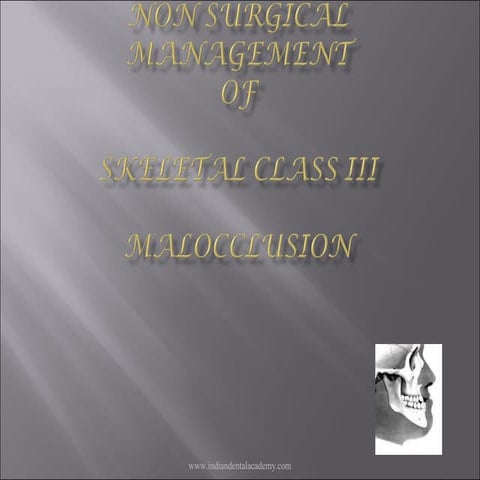 Non surgical management of Class 3 malooclusion /certified fixed orthodontic ...
