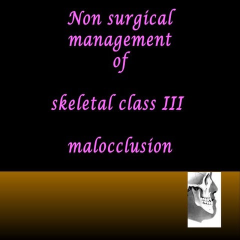 Non surgical management of class 3 skeletal mal occlusion  / fixed orthodonti...