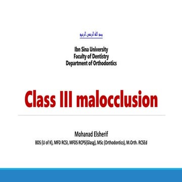 Class iii malocclusion