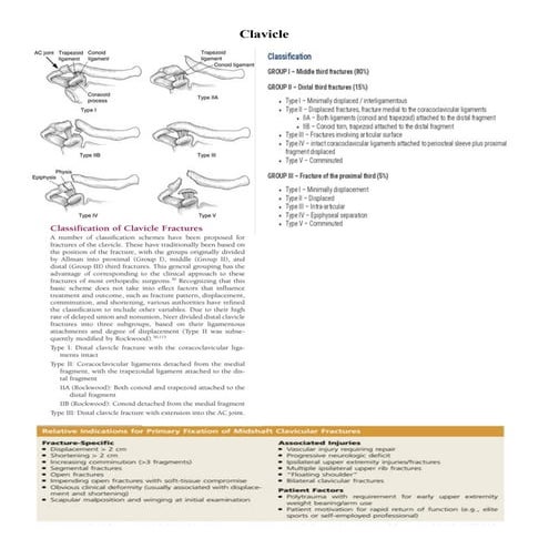 Clavicle fracture | PDF