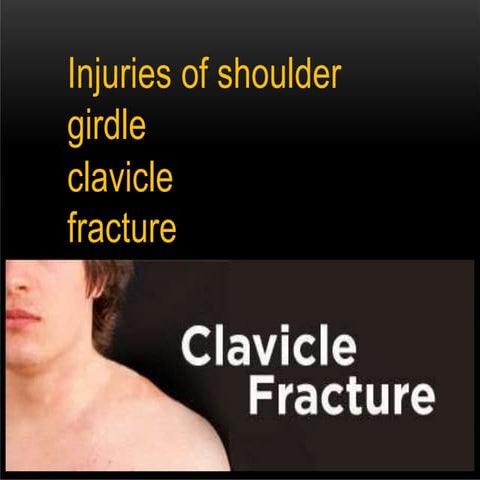Clavicle fracture