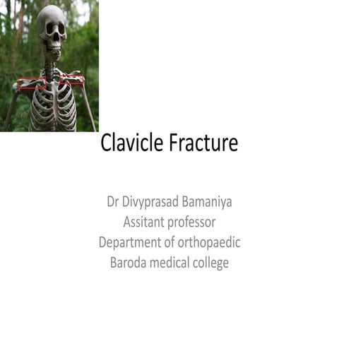 Clavicle fracture & injuries around shoulder