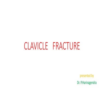 Clavicle fracture