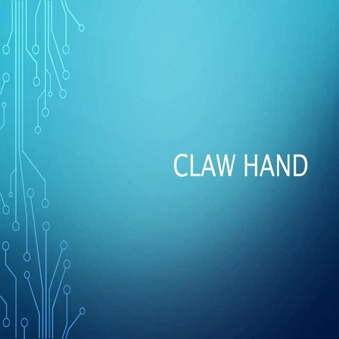 Claw Hand,Definition,Causes,Types,Symptoms and Management | PPTX