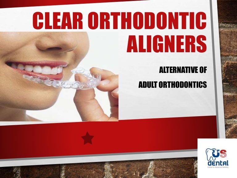 Clear Orthodontic Aligners