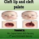 Cleft lip and cleft palate ppt