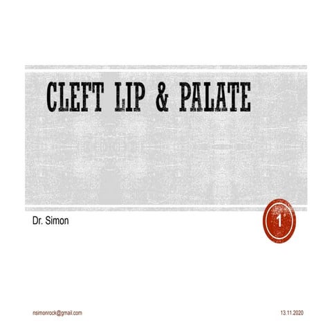 Cleft lip &amp; palate