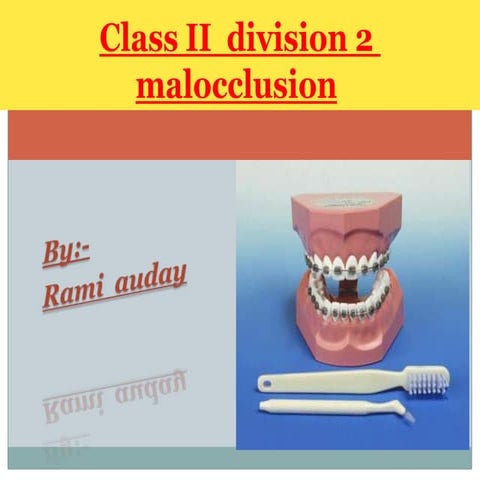 class ii division 2 malocclusion