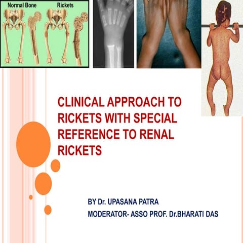 Clinical approach to rickets with special reference to renal rickets ...
