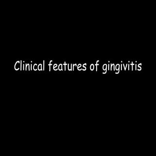 Clinical features ofgingivitis. per...