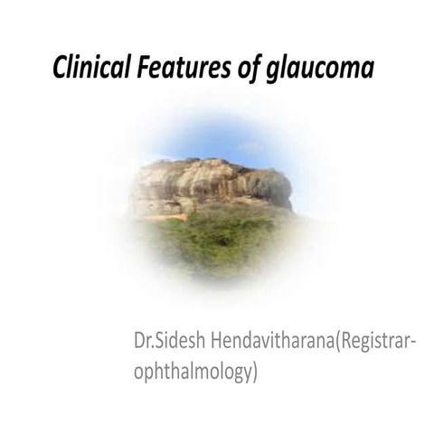 Clinical features of glaucoma