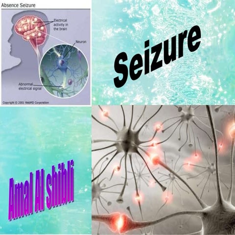 Clinical series.seizure
