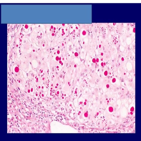 Clinical Pathology Block C Images Study Questions_Mari-Alina Timoshchuk ...