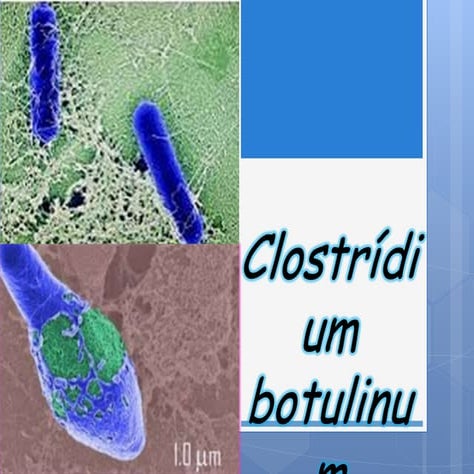 Clostridium botulinum