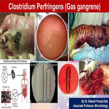 Clostridium perfringens.pptx