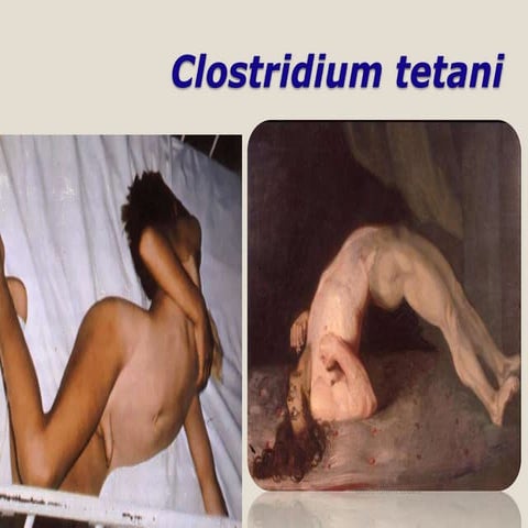 CLOSTRIDIUM TETANI FINAL - Copy.pptx