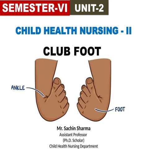 Semester 6 Unit 2 Club foot (talipes).pptx