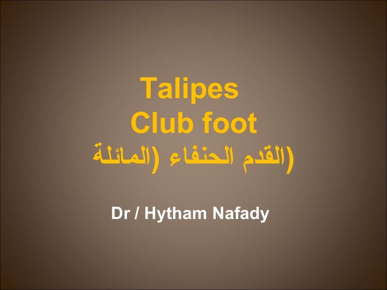 Club Foot Deformity