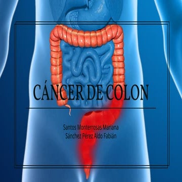 Pesentacion de Cancer de colon de la materia de oncologia | PDF