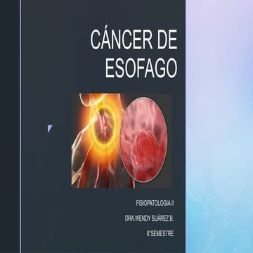 Cancer-de-esofago-concepto-fisiologia-y-anatomia.pptx