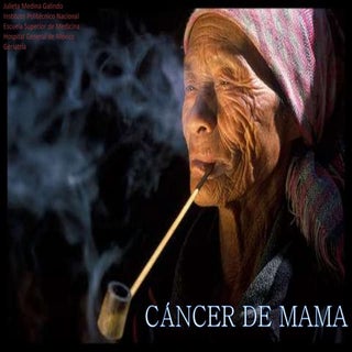 Cáncer de Mama en el Adulto Mayor