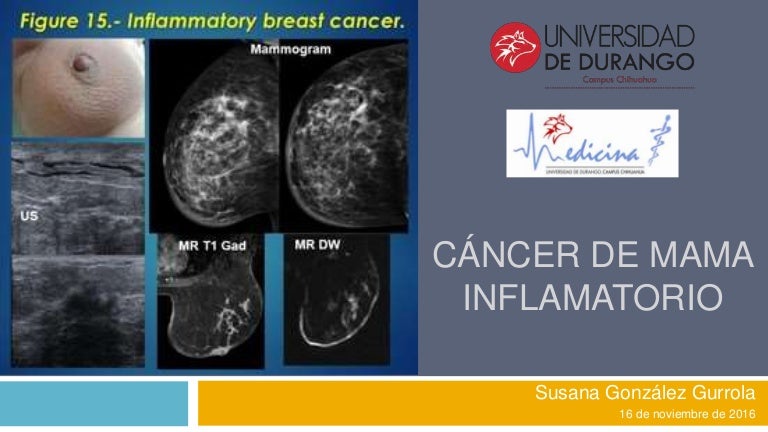 efecte medicinale giardia cancer endometrial tipos