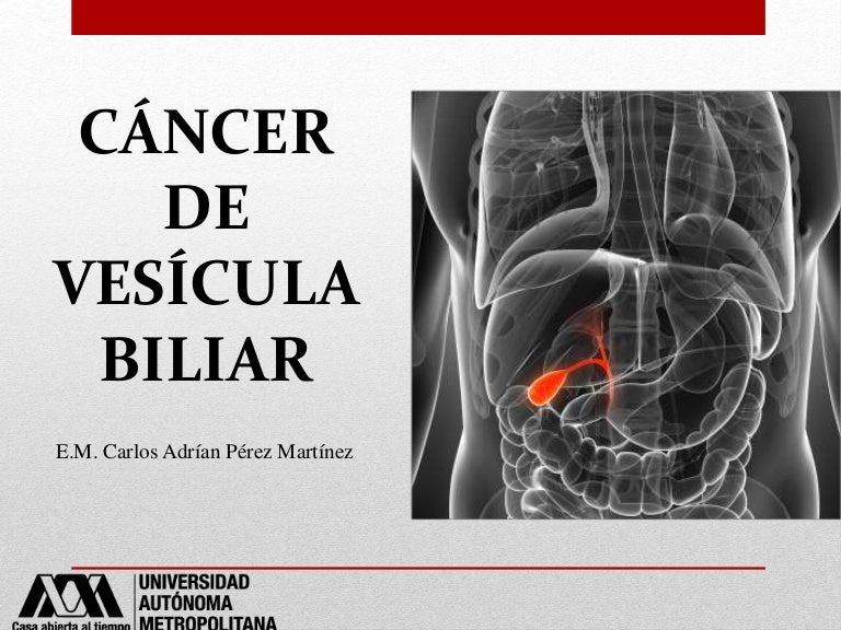 cancer biliar imagenes