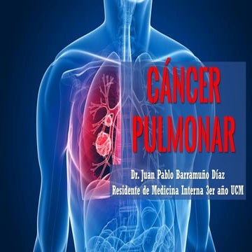Cáncer pulmonar