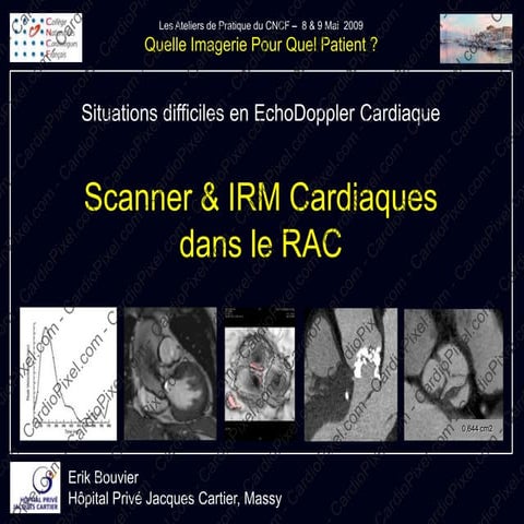 Scanner & IRM dans le RAC | PPTX