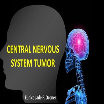 CNS TUMOR (Radiology) By Oconer