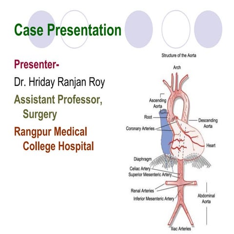 Coarctation of Aorta - A case report
