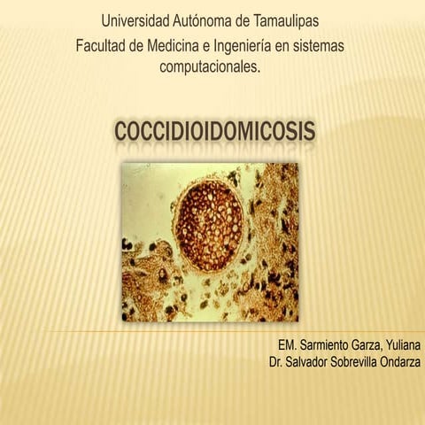 Coccidioidomicosis