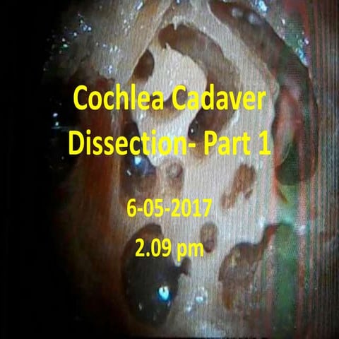Cochlea cadaver dissection - part 1