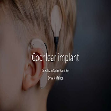 Cochlear Implant complete presentation by Dr Salison Salim Panicker