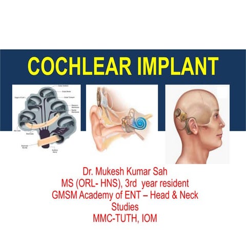 Cochlear implant  mukace final
