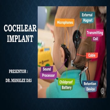 Presentation (9).pptx cochlear implant CI | PPTX