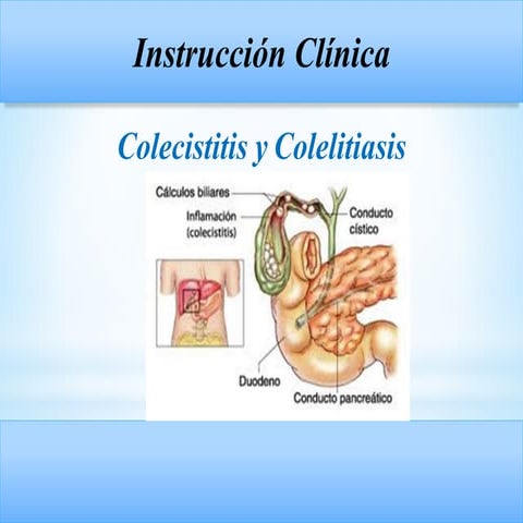 Colecistitis su fisiopatologia, causas y cuidados de enfermeria