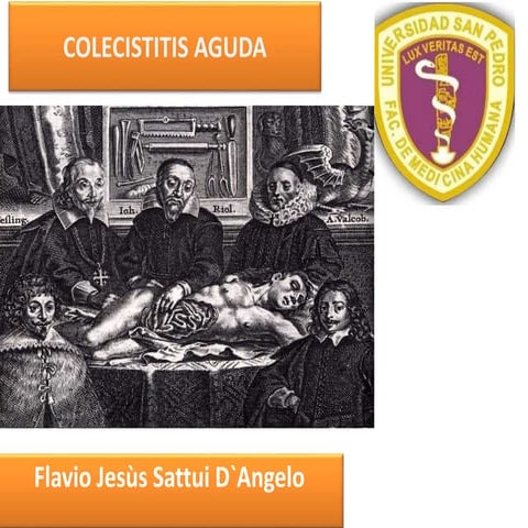 Colecistitis aguda
