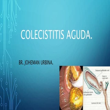 Colecititis.  Joheman Urbina