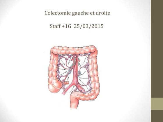 Colectomie gauche et droite 