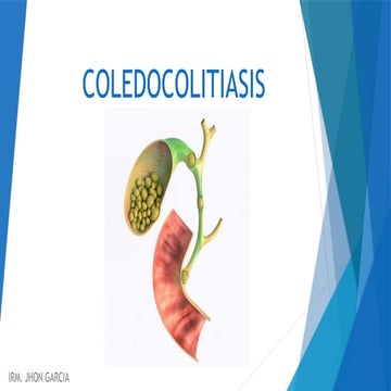 COLEDOCOLITIASIS concepto y clasificación def.pptx