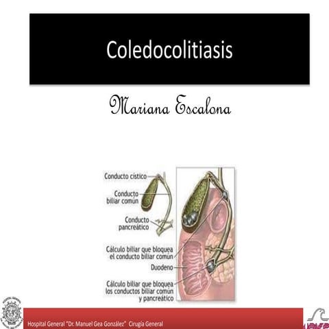 Coledocolitiasis 