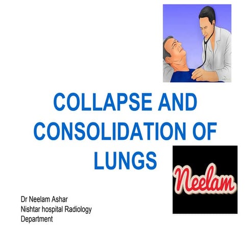 Collapse and consolidation Lung Radiology