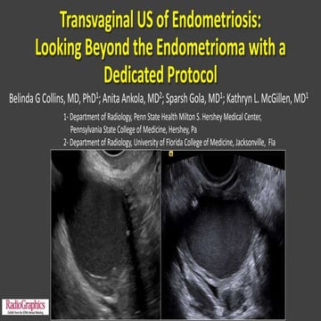 Collins Endometriosis TVS Radiopgrahics 2019.pptx