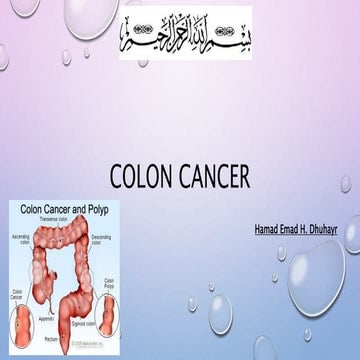 Colon cancer 