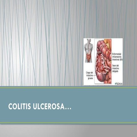COLON Y RECTO, clasificacion, anatomía patológica, epidemiología | PPTX