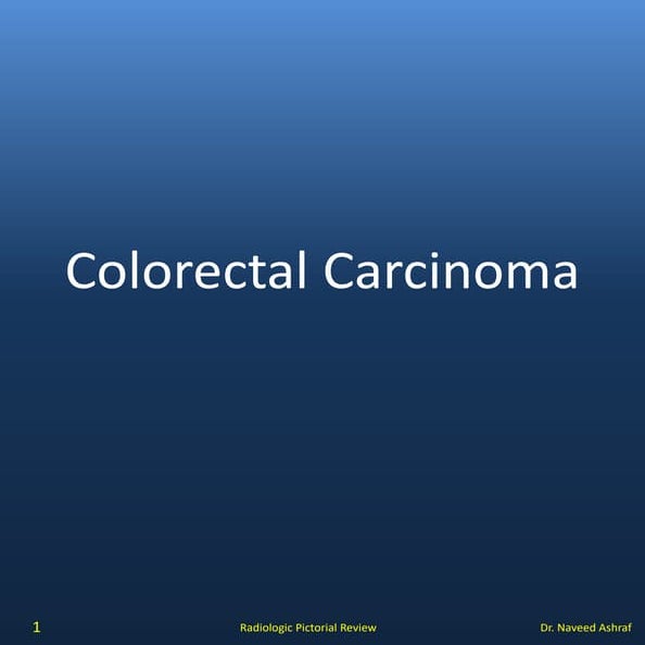 Coloretcal carcinoma