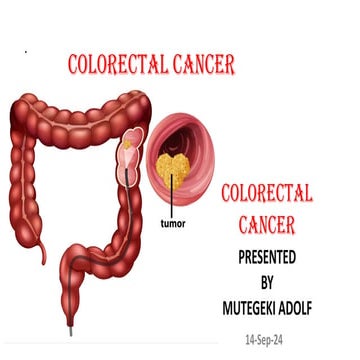 Colorectal cancer (CRC), cancer of the rectum and colon | PDF
